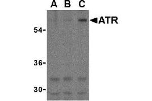 Western Blotting (WB) image for anti-ATR serine/threonine kinase (ATR) (C-Term) antibody (ABIN1030269) (ATR 抗体  (C-Term))