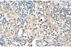 Immunohistochemistry (IHC) image for anti-phosphoserine Aminotransferase 1 (PSAT1) (N-Term) antibody (ABIN2782576)