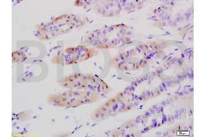 Formalin-fixed and paraffin embedded mouse stomach tissue labeled with Anti-Tenascin C/Tn-C Polyclonal Antibody, Unconjugated (ABIN736761) at 1:200 followed by conjugation to the secondary antibody and DAB staining (TNC 抗体  (AA 1001-1100))