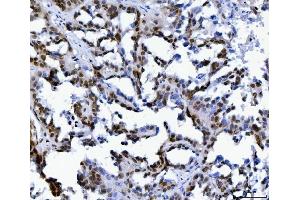 IHC analysis of MBNL1 using anti-MBNL1 antibody (ABIN7602608).