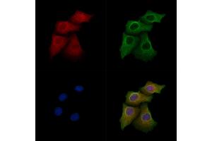 ABIN7094675 and ABIN7098726 staining Hela cells by IF/ICC. (ART4 抗体  (N-Term))
