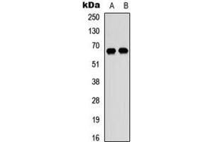 Western blot analysis of DDX52 expression in HEK293T (A), Raji (B) whole cell lysates. (DDX52 抗体  (C-Term))