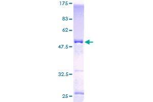 KCNIP4 Protein (AA 1-250) (GST tag)