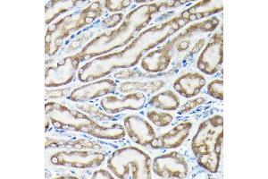 Immunohistochemistry (IHC) image for anti-NLR Family, Pyrin Domain Containing 1 (NLRP1) (AA 1000-1100) antibody (ABIN7268935)