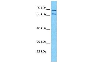 Western Blotting (WB) image for anti-Neuroblastoma Breakpoint Family, Member 11 (NBPF11) (Middle Region) antibody (ABIN2791692) (NBPF11 抗体  (Middle Region))
