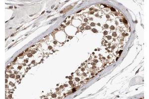 ABIN6267348 at 1/100 staining human Testis tissue sections by IHC-P. (MYB 抗体  (pSer532))