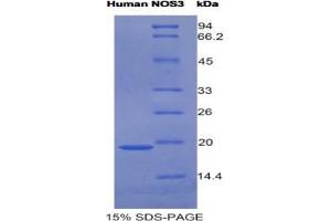 SDS-PAGE analysis of Human NOS3 Protein. (ENOS 蛋白)