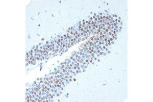 Immunohistochemistry of paraffin-embedded mouse brain using CHD3 Rabbit mAb (ABIN7266363) at dilution of 1:100 (40x lens). (CHD3 抗体)
