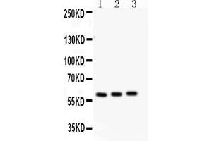 Anti-CYP11A1 antibody, Western blottingAll lanes: Anti CYP11A1  at 0. (CYP11A1 抗体  (N-Term))