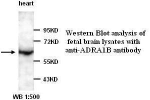 Image no. 1 for anti-Adrenergic, alpha-1B-, Receptor (ADRA1B) antibody (ABIN790879) (ADRA1B 抗体)