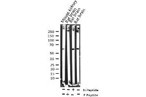Western blot analysis of Phospho-Myc (Thr58) expression in various lysates (c-MYC 抗体  (pThr58))