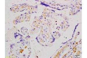 Formalin-fixed and paraffin embedded human placenta tissue labeled with Anti-Angiomotin Polyclonal Antibody, Unconjugated (ABIN754873) at 1:200 followed by conjugation to the secondary antibody and DAB staining (Angiomotin 抗体  (AA 545-620))