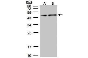 WB Image Sample(30 μg of whole cell lysate) A:Hep G2, B:MOLT4, 12% SDS PAGE antibody diluted at 1:1000 (Pyruvate Dehydrogenase E1 alpha (Center) 抗体)