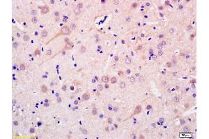 Formalin-fixed and paraffin embedded rat brain labeled with Anti-ADCY1 Polyclonal Antibody, Unconjugated (ABIN702565) at 1:200 followed by conjugation to the secondary antibody and DAB staining. (ADCY1 抗体  (AA 751-850))