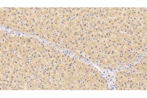 Detection of F12 in Human Liver Tissue using Polyclonal Antibody to Coagulation Factor XII (F12) (F12 抗体  (AA 400-615))