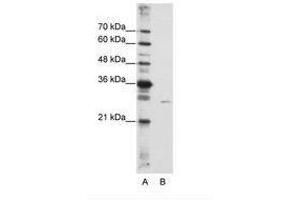 Image no. 2 for anti-EMG1 Nucleolar Protein Homolog (EMG1) (AA 51-100) antibody (ABIN6736233) (EMG1 抗体  (AA 51-100))