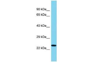 Host: Rabbit Target Name: IL34 Sample Type: U937 Whole Cell lysates Antibody Dilution: 1. (IL-34 抗体  (N-Term))
