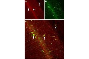 Immunohistochemistry (IHC) image for anti-Calcium Channel, Voltage-Dependent, beta 3 Subunit (CACNB3) (AA 463-477), (Intracellular) antibody (ABIN7042987)