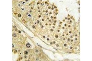 Immunohistochemistry (IHC) image for anti-Aurora Kinase B (AURKB) (AA 6-35) antibody (ABIN3030076)