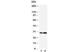 Western blot testing of LASP1 antibody and Lane 1:  HeLa (LASP1 抗体  (C-Term))