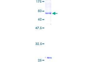 Image no. 2 for Cyclin-Dependent Kinase 18 (CDK18) (AA 1-472) protein (GST tag) (ABIN1314378)