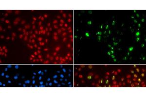 Immunofluorescence analysis of GFP-RNF168 transgenic U2OS cells using DNA polymerase eta Polyclonal Antibody (POLH 抗体)