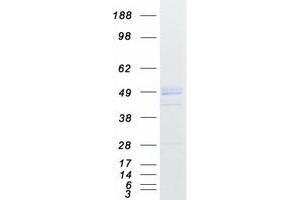 Western Blotting (WB) image for Migration and Invasion Inhibitory Protein (MIIP) protein (Myc-DYKDDDDK Tag) (ABIN2726013)