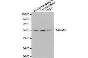 Western blot analysis of extracts of various cell lines, using CDC25A antibody. (CDC25A 抗体  (AA 235-484))