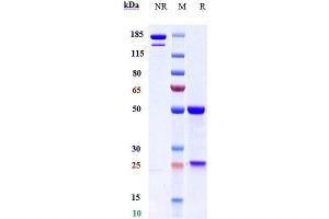 Anti-MASP2 Reference Antibody (narsoplimab) on SDS-PAGE under reducing (R) condition. (Recombinant MASP2 (Narsoplimab Biosimilar) 抗体)