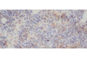 Immunohistochemistry of paraffin-embedded Rat spleen using RELB Polyclonal Antibody at dilution of 1:50 (RELB 抗体)