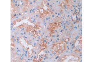 Used in DAB staining on fromalin fixed paraffin- embedded kidney tissue (Tec Protein Tyrosine Kinase (TEC) (AA 370-623) 抗体)