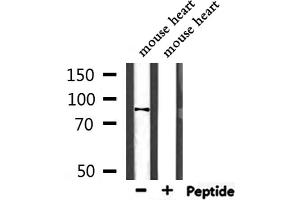 Western blot analysis of extracts from mouse heart, using NEB2 Antibody. (PPP1R9B 抗体  (C-Term))