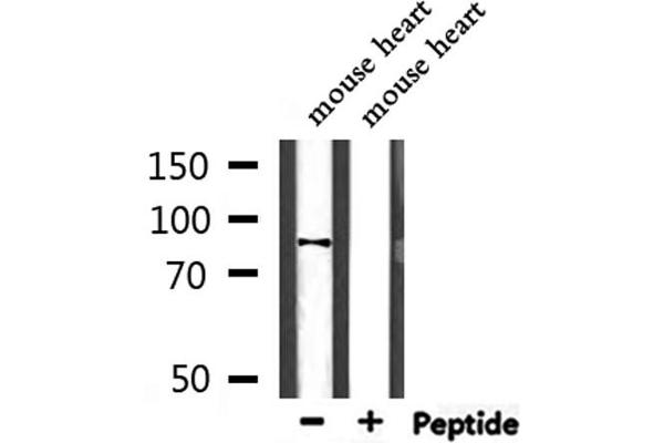 PPP1R9B 抗体  (C-Term)
