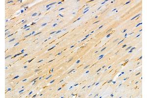 ABIN6265213 and ABIN6276429 at 1/100 staining Rat heart tissue by IHC-P.