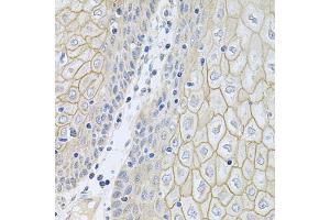 Immunohistochemistry of paraffin-embedded human esophagus using NCR3 antibody (ABIN5974302) at dilution of 1/100 (40x lens). (NCR3 抗体)