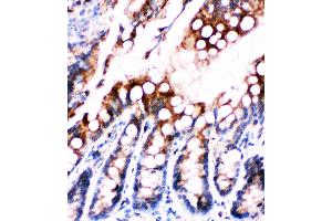 Anti-Fatty Acid Binding Protein 5 antibody, IHC(P) IHC(P): Rat Intestine Tissue (FABP5 抗体  (N-Term))