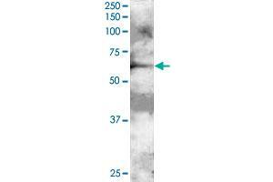 GRB7 polyclonal antibody  staining (2 ug/mL) of A-431 lysate (RIPA buffer, 30 ug total protein per lane).