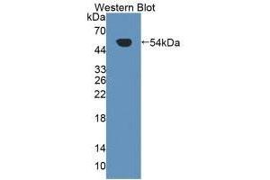 Detection of Recombinant Kim1, Human using Polyclonal Antibody to Kidney Injury Molecule 1 (Kim1) (HAVCR1 抗体  (AA 21-240))