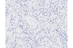 ABIN570861 Negative Control showing staining of paraffin embedded Human Cerebellum, with no primary antibody. (NIPBL 抗体  (AA 889-902))