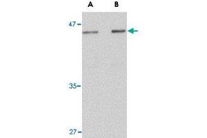 Western blot analysis of LASS5 in rat brain tissue lysate with LASS5 polyclonal antibody  at (A) 1 and (B) 2 ug/mL . (LASS5 抗体  (N-Term))