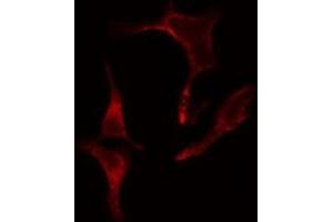 ABIN6275641 staining LOVO cells by IF/ICC. (EIF2B4 抗体  (Internal Region))