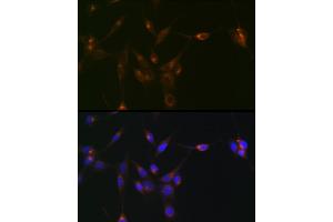 Immunofluorescence analysis of NIH/3T3 cells using PDLIM1/CLP36 Rabbit mAb (ABIN7269195) at dilution of 1:100 (40x lens). (PDLIM1 抗体)