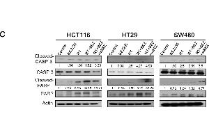 BEZ235 maintenance treatment following RT + BEZ235 treatment resulted in significantly less cell survival and more apoptosis markers in CRC cells. (Actin, gamma 1 抗体  (N-Term))
