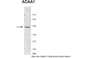 Sample Type: 1. (ACAA1 抗体  (N-Term))
