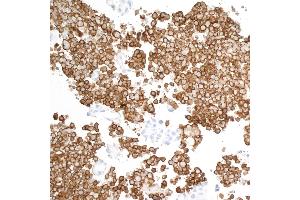 Immunohistochemistry (IHC) image for anti-CD163 (CD163) (AA 850-900) antibody (ABIN7448890) (Recombinant CD163 抗体  (AA 850-900))