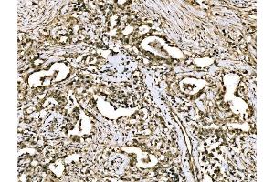 IHC analysis of WAPL/FOE using anti-WAPL/FOE antibody (ABIN7602663).