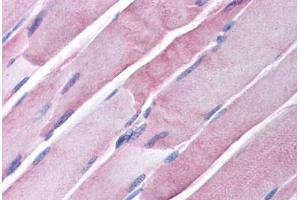 Human Skeletal Muscle (formalin-fixed, paraffin-embedded) stained with GOT2 antibody ABIN291150 at 20 ug/ml followed by biotinylated secondary antibody, alkaline phosphatase-streptavidin and chromogen. (GOT1 抗体)