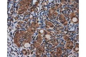 Immunohistochemical staining of paraffin-embedded Kidney tissue using anti-KIAA1609 mouse monoclonal antibody. (KIAA1609 抗体)