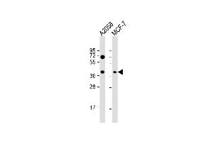 All lanes : Anti-GNA12 Antibody (S67) at 1:1000 dilution Lane 1:  whole cell lysate Lane 2: MCF-7 whole cell lysate Lysates/proteins at 20 μg per lane. (GNA12 抗体  (AA 46-75))