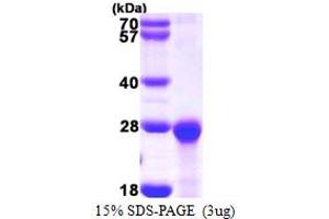 SDS-PAGE (SDS) image for PEST Proteolytic Signal Containing Nuclear Protein (PCNP) (AA 1-178) protein (His tag) (ABIN667948) (PCNP Protein (AA 1-178) (His tag))